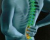 Lower Back Pain – Sciatica