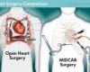 How Mitral Valve Repair Surgery Is Performed