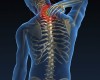 Сauses of neck and back pain