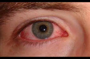 men's health dry eye