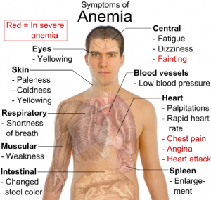 symptoms of anemia-men's health