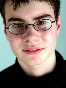 teen acne men's health