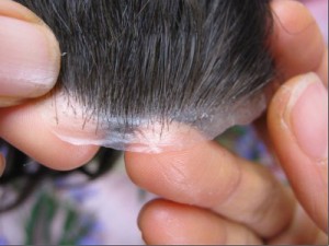 toupees men's health