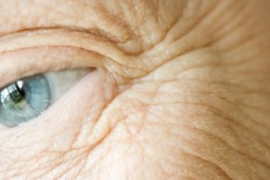 wrinkles men's health